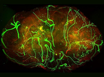 Anti-cancer Neurons