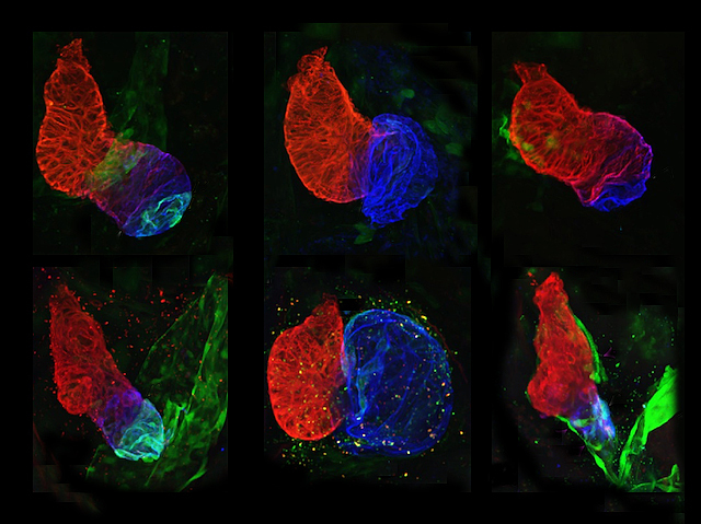 Developing a Heart